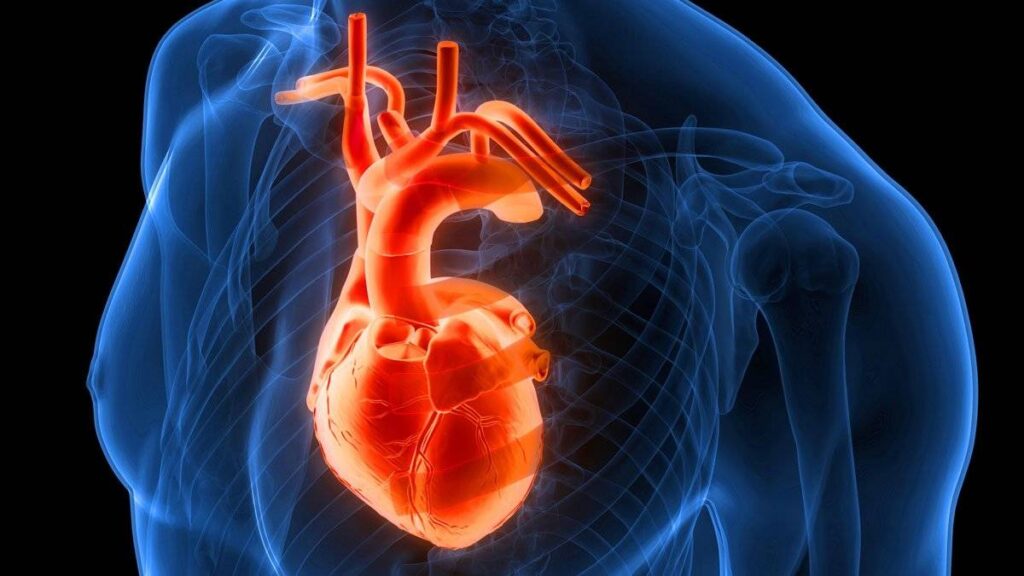 Atrial Fibrillation