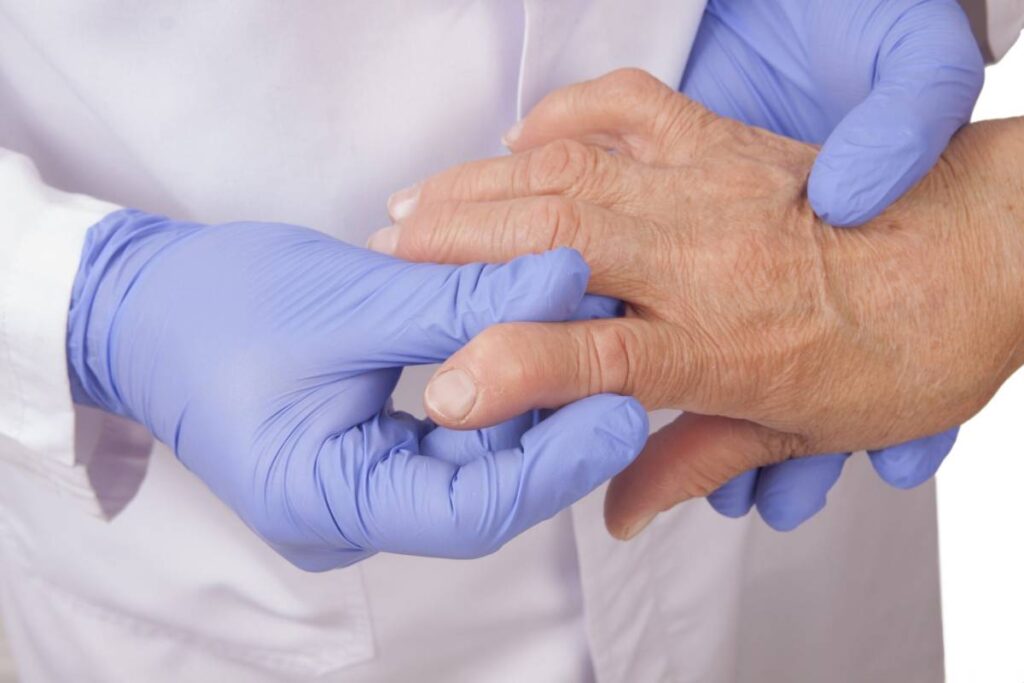 Tips to Manage and Protect Your Skin with Arthritis