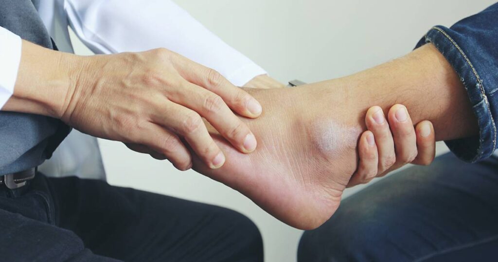 Treatment Options for Foot Arthritis