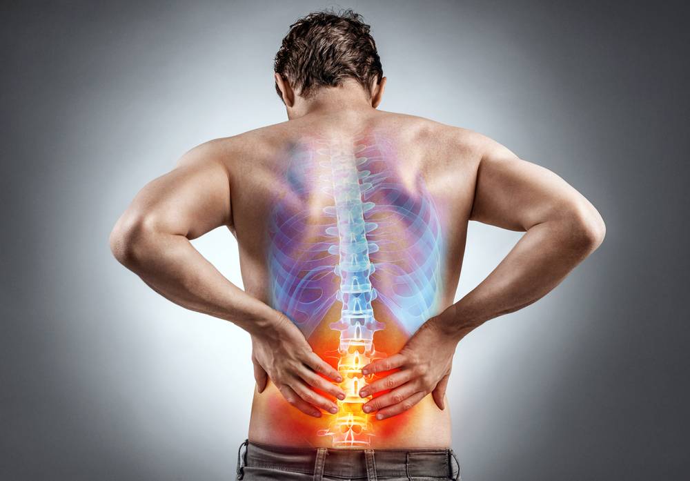 Psa Back Back Pain Due To Psoriatic Arthritis: How To Get Relief