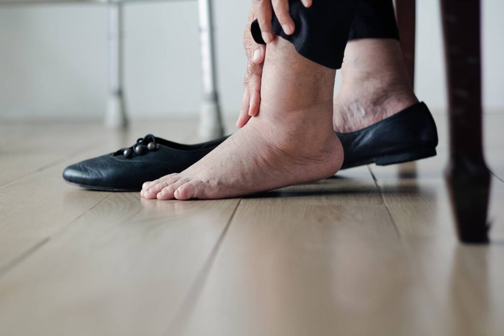 foot arthritis