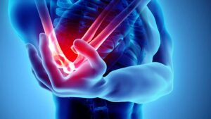 How an Orthopedic Doctor Diagnoses Elbow Pain