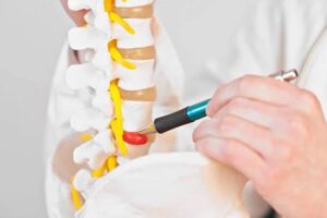 Surgical Treatment Options