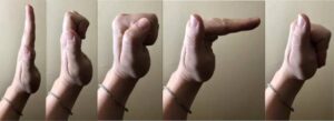 Tendon Glides
