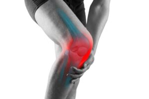 What is Osteoarthritis of the Knee