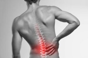 What is Spinal Arthritis