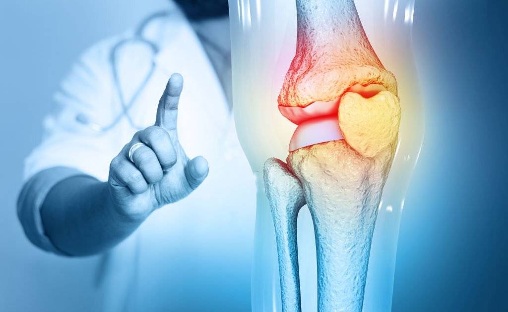 osteoarthritis of the knee